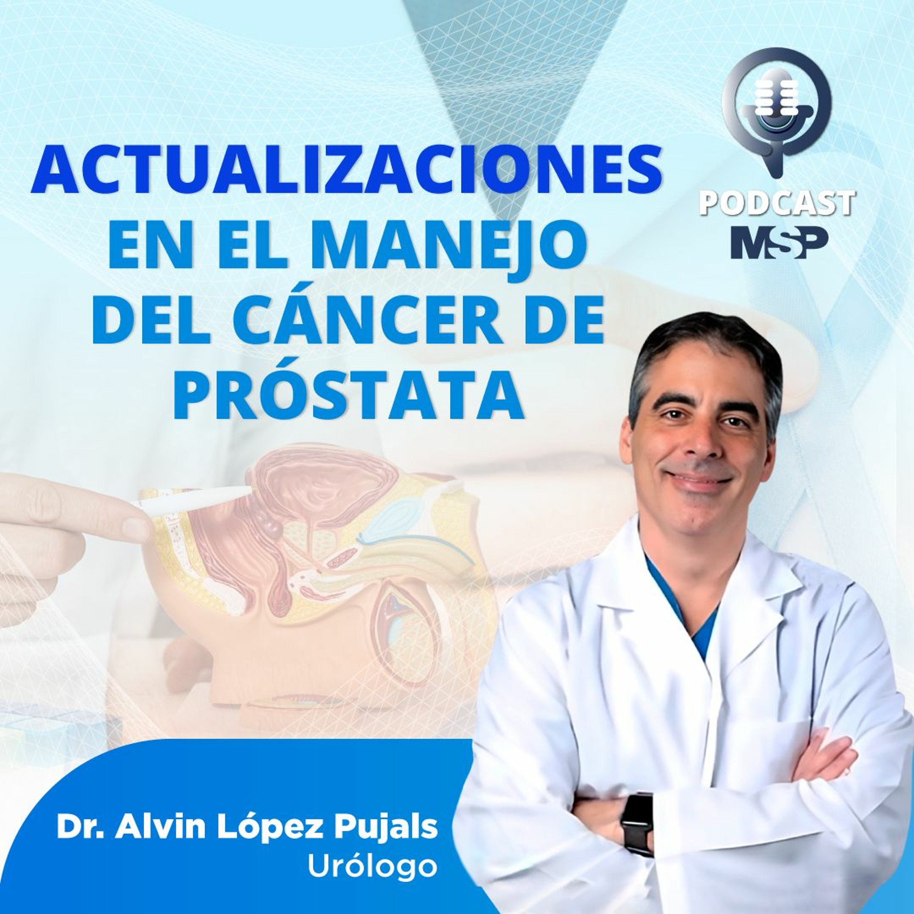 Actualizaciones en el manejo del cáncer de próstata