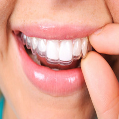 Invisalign vs. Traditional Braces Which is Right for You