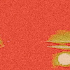 Shorty (Remix)