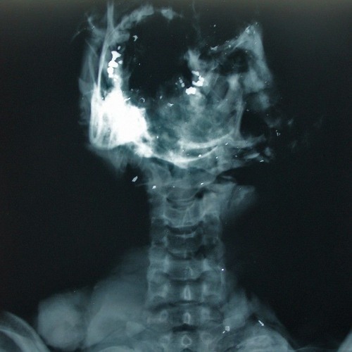 .12 gauge in my brain