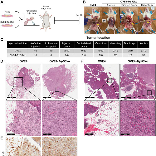 Loss of Trp53 Gene Promotes Tumor Growth and Immune Suppression in Ovarian Cancer