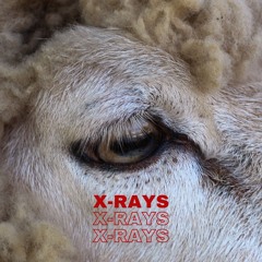 X-Rays DEMO