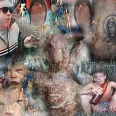 .блч больн#Ых рубمو