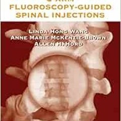 ❤️ Read The Handbook of C-Arm Fluoroscopy-Guided Spinal Injections by Linda Hong Wang,Anne Marie
