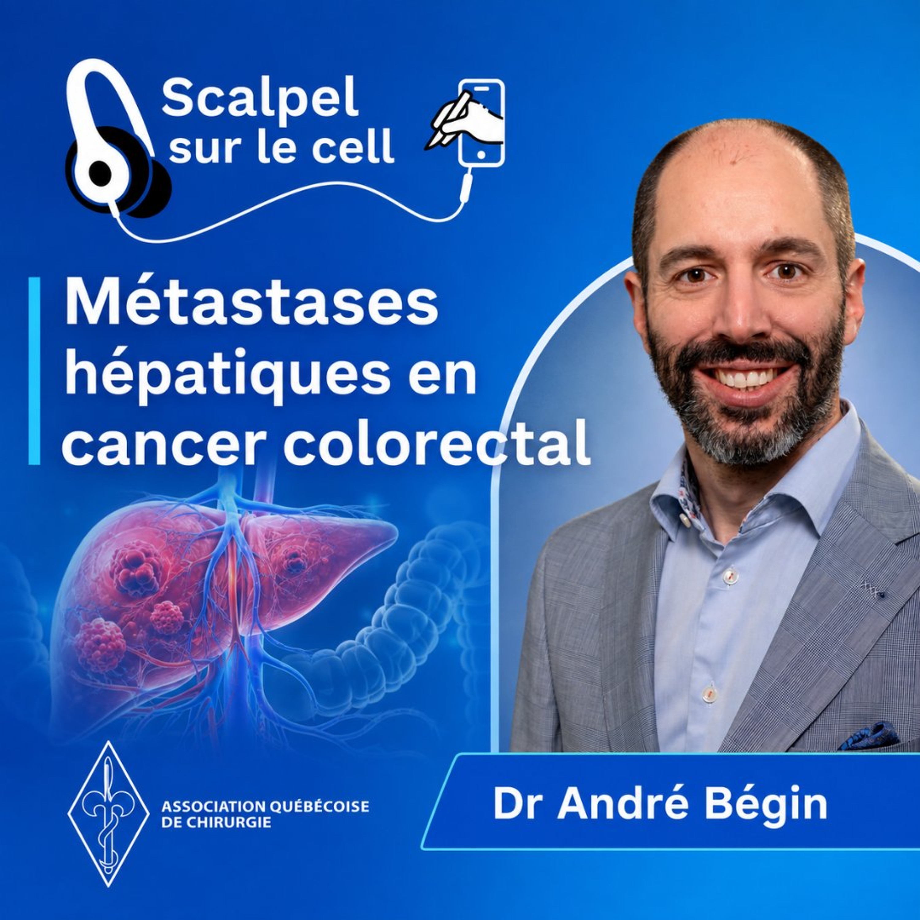 Ép 9 | Les métastases hépatiques en cancer colorectal. Dr André Bégin