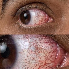 Eye saw something Eye shouldn't