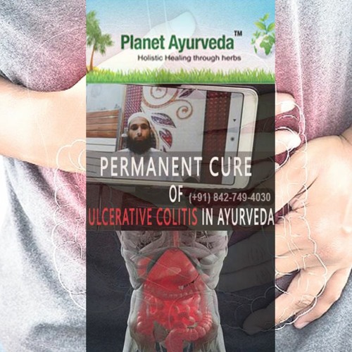 Ulcerative Colitis Treatment Through Ayurveda - Patient Review