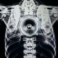 risklvp tumor #angelboys