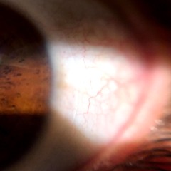 zillainmyeyez (demo)