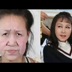 Mujer china se quitó 50 años de encima con cirugía plástica