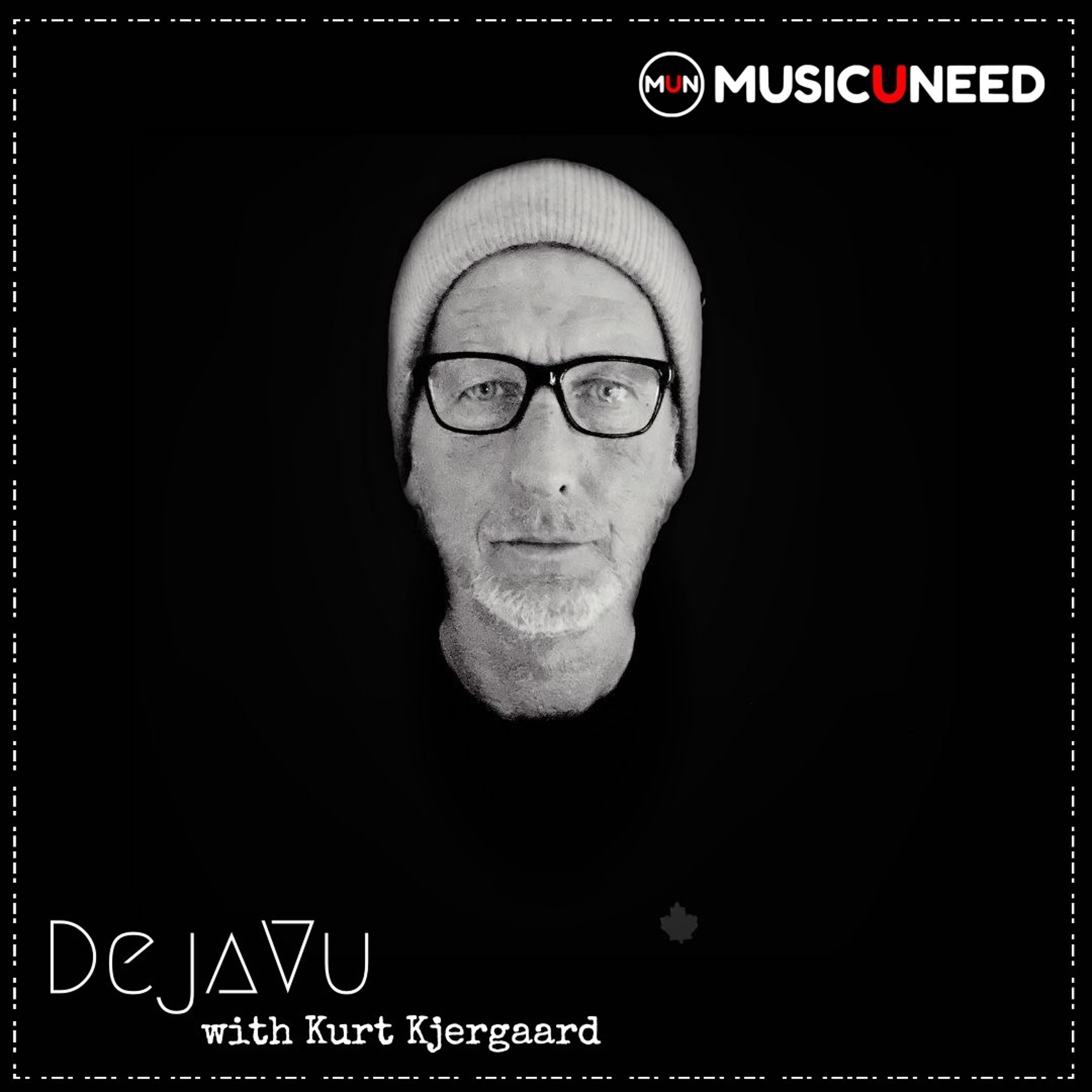 MUSICUNEED