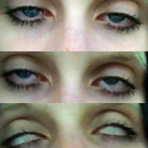 psychedelics