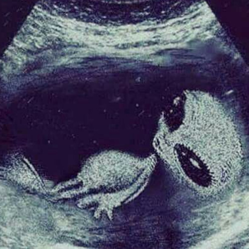 No Shoulder (p. Pietsbeats)