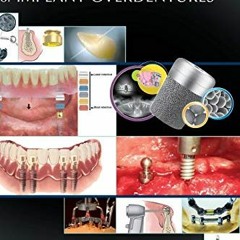 ACCESS EPUB KINDLE PDF EBOOK Clinical and Laboratory Manual of Implant Overdentures b