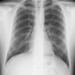 Ciğerlerim Bağrır