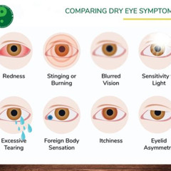 Best Treatment For Dry Eyes Symptoms Reviews