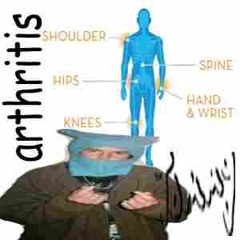 arthritis (prod finalfanasy)