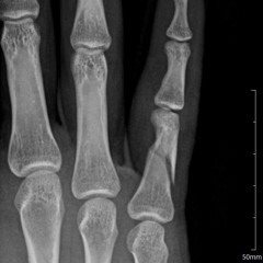 A$AP Rocky ft A$AP Ferg - Take It Easy Freestyle