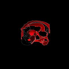 Neurodance