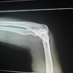 I Recorded These Guitars With A Slighty Broken Arm (SM)