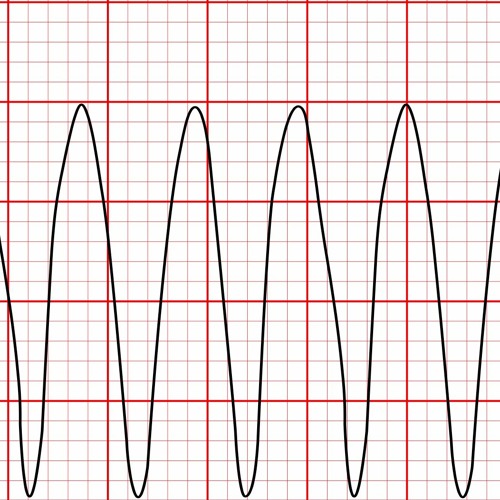 Ventricular Rhythms 2021