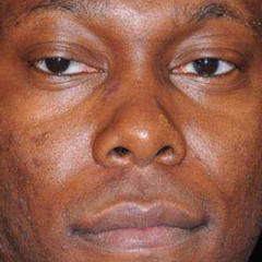 Stand up tall - Rott (Free DL)