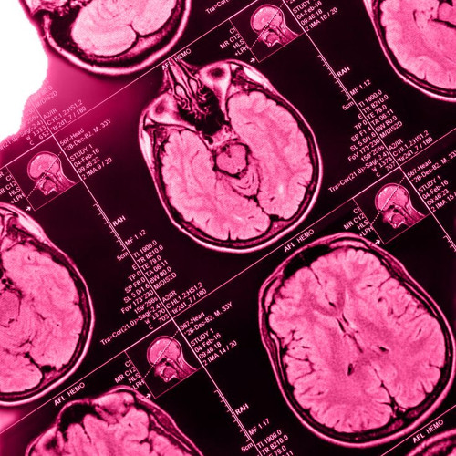 Echo Ward 2000 || Hans-Bunte-Areal Generation New Contest