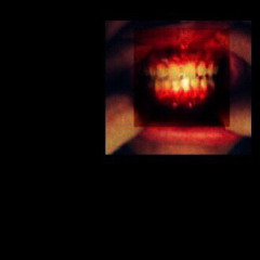 PROXY15