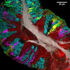 Mapping Out The ‘Microbial Skyscrapers’ On Your Tongue