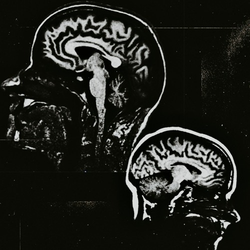 Ischemic