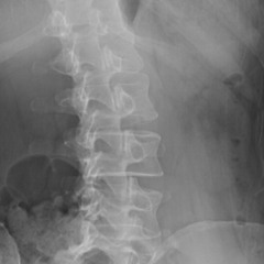 Spinal Jazz (Dibiflipsession01)