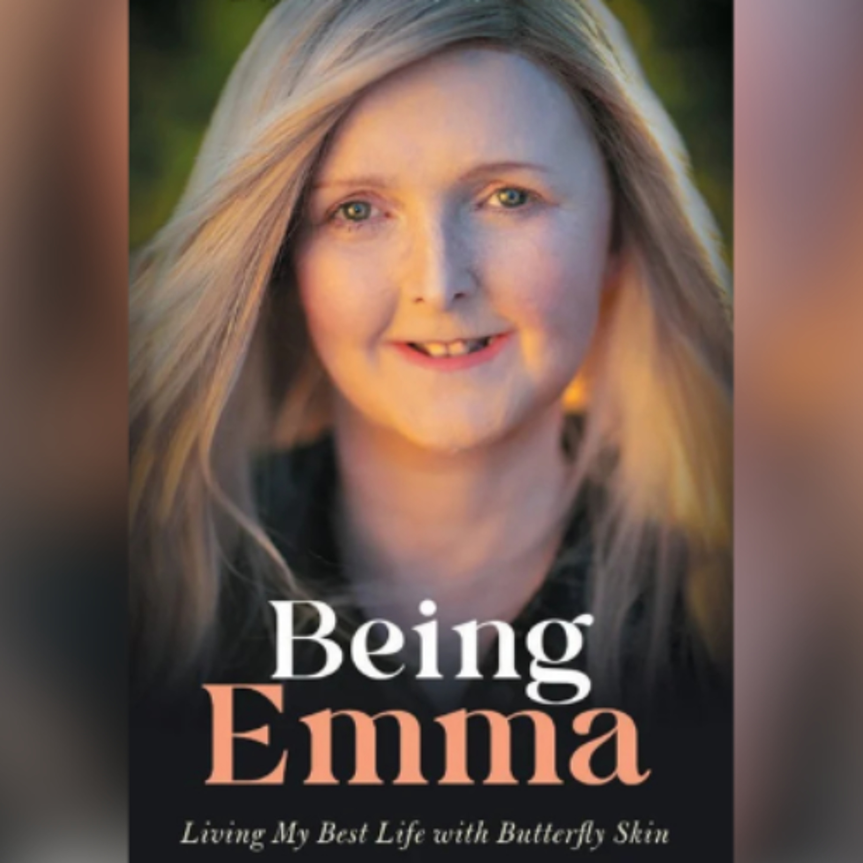 BEING EMMA – Living My Best Life with Butterfly Skin