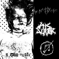 Hemoptysis- kill all posers