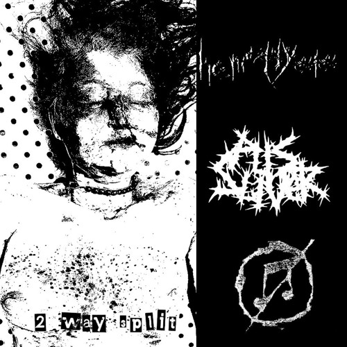 Hemoptysis- kill all posers