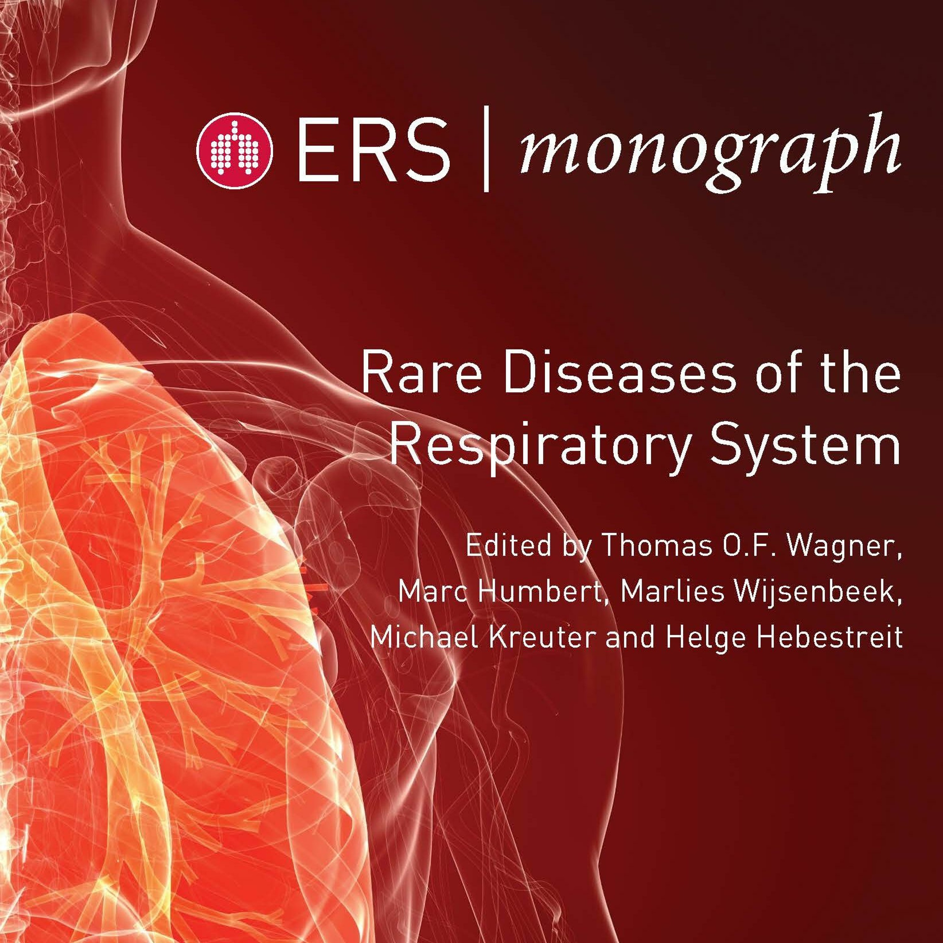 ERS Monograph: Rare Diseases of the Respiratory System