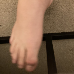 Obese