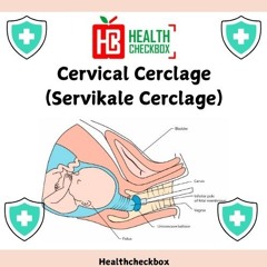 Cervical Cerclage (Servikale Cerclage)