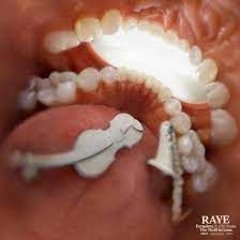 RAYE - Escapism. Feat. 070 Shake (Jet Voon Remix)