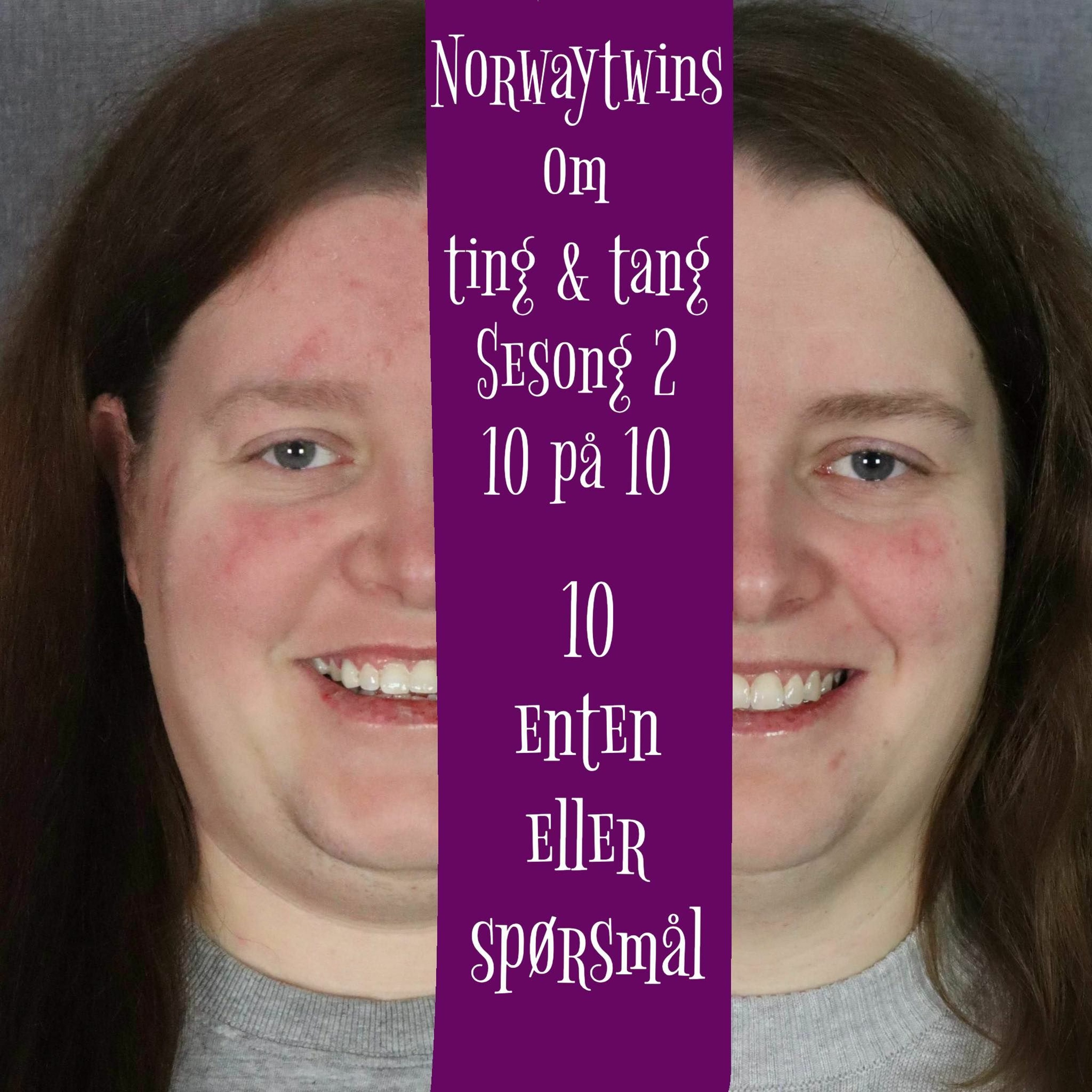 10 På 10 (Sesong 2) Episode 13: 10 Enten Eller Spørsmål episode artwork