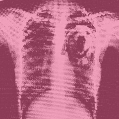 we not the same           [blackwell]