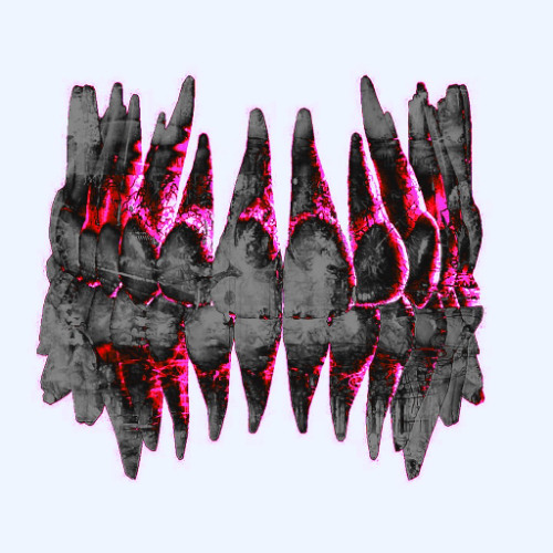 Toothaches
