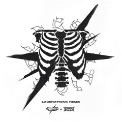 LACERATIONS ! (UB REMIX)
