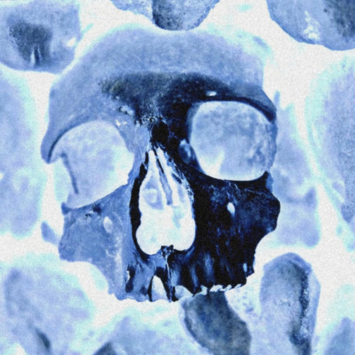 Broken Bones
