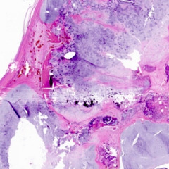 cartilaginous contagion