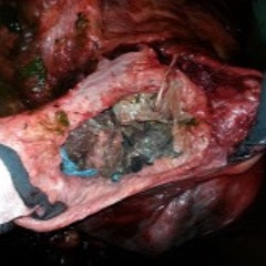 SHOOt6t1LaT (BluBBeR TooL)