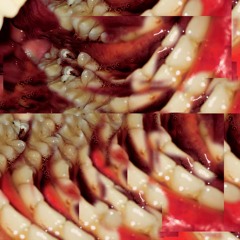 Hypochondriac (Karhide Remix)