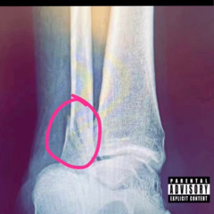Worldwide Gary “Anutha Olean Song” (Ankle Tape) beat by b33thozart