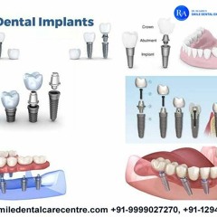 Best Dental Implant Clinic in Faridabad Looking