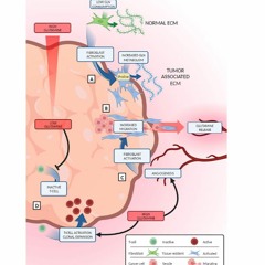 Inhibiting Glutamine Metabolism Impacts Tumor Cells or the Microenvironment?