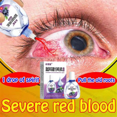 Best Eye Blood Clot Treatment Reviews